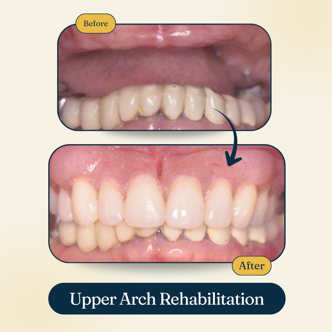 Patient smile result