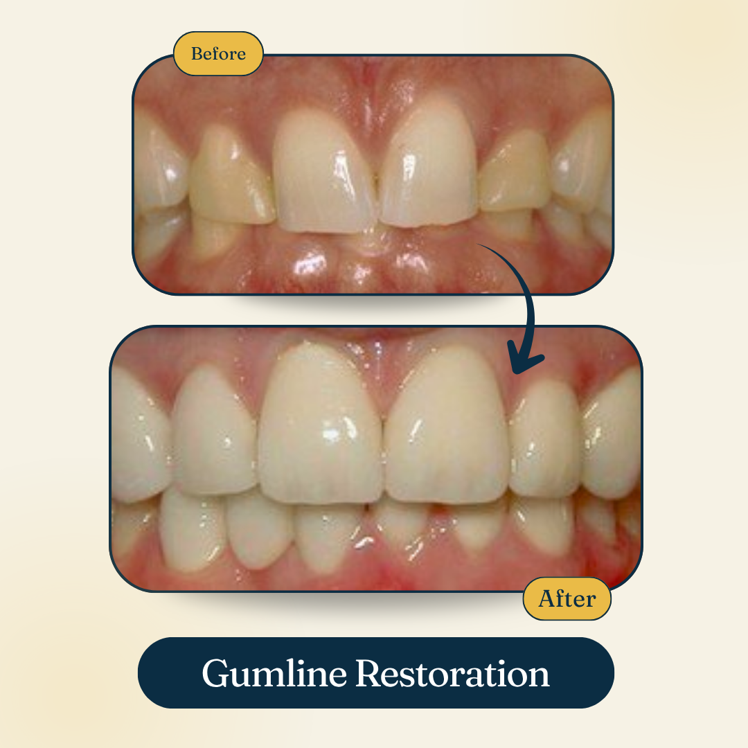 Patient smile result