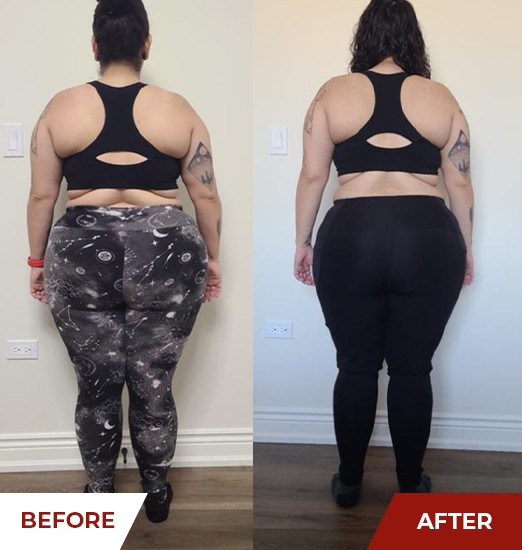 Client back view before and after