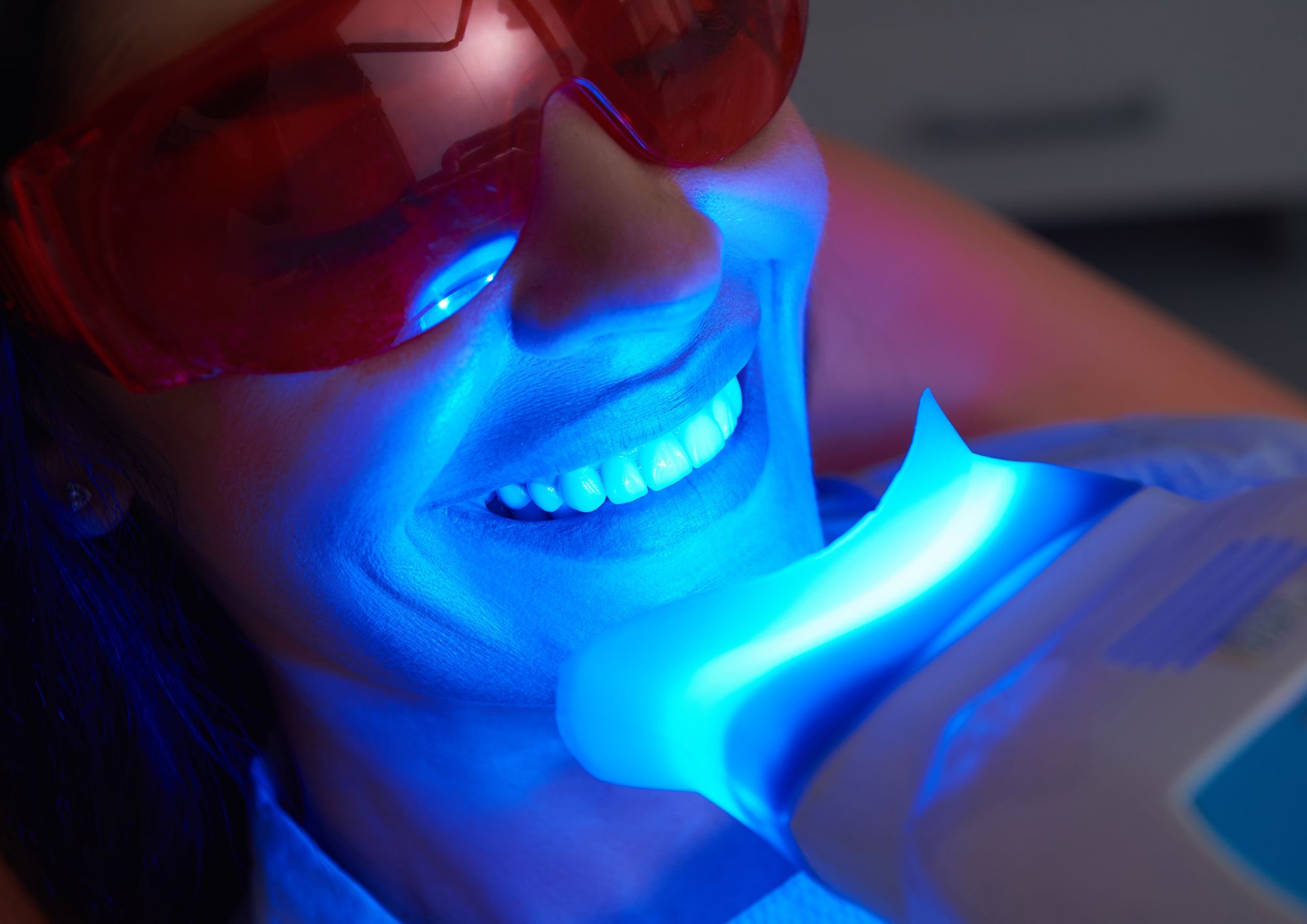 Teeth whitening treatment