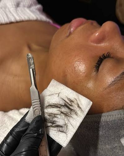 Derma-Glow dermaplaning facial