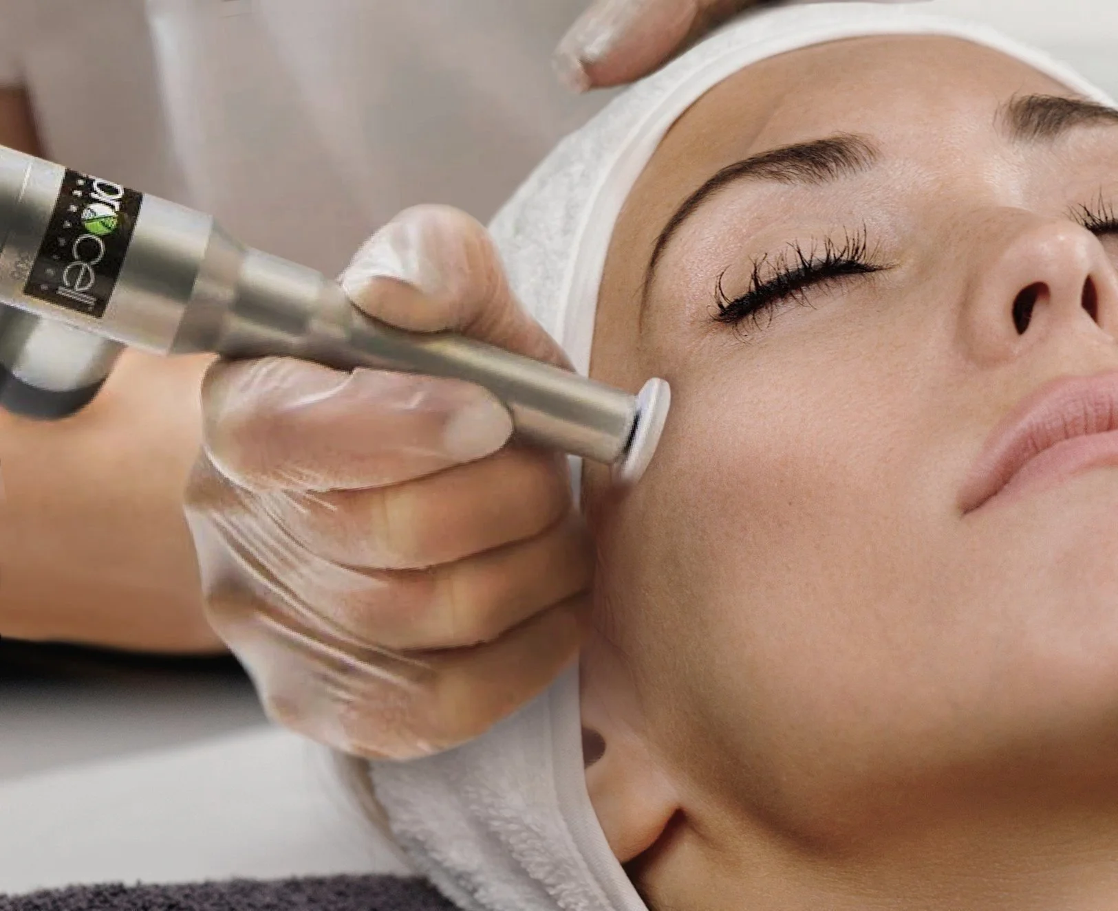 Microchanneling facial at Nectar at the Villa