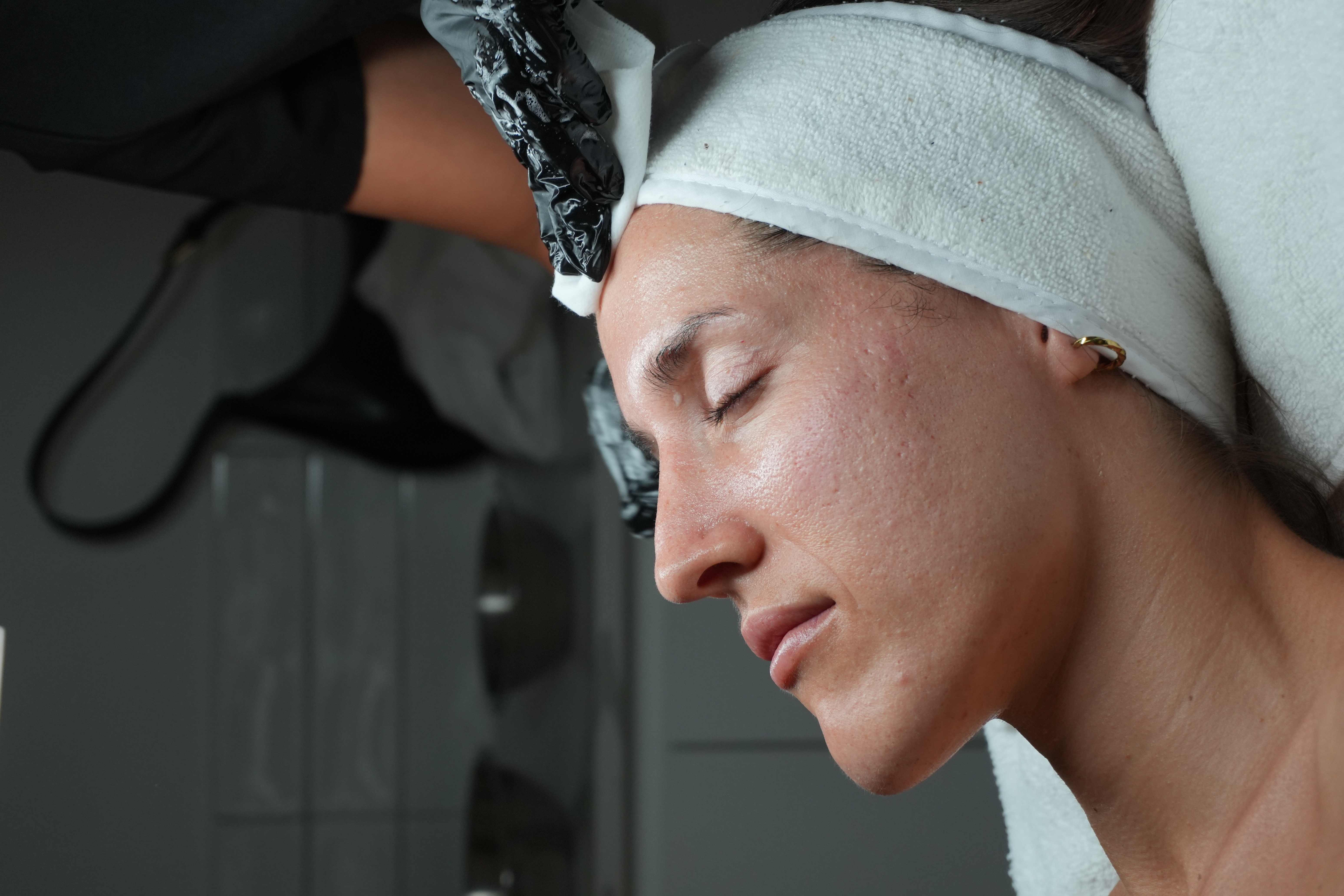 Winter Skin Reset assessment at Facetology RN