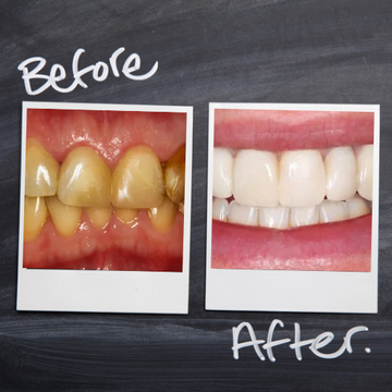 See before and after photos of Dr. Birch's patients