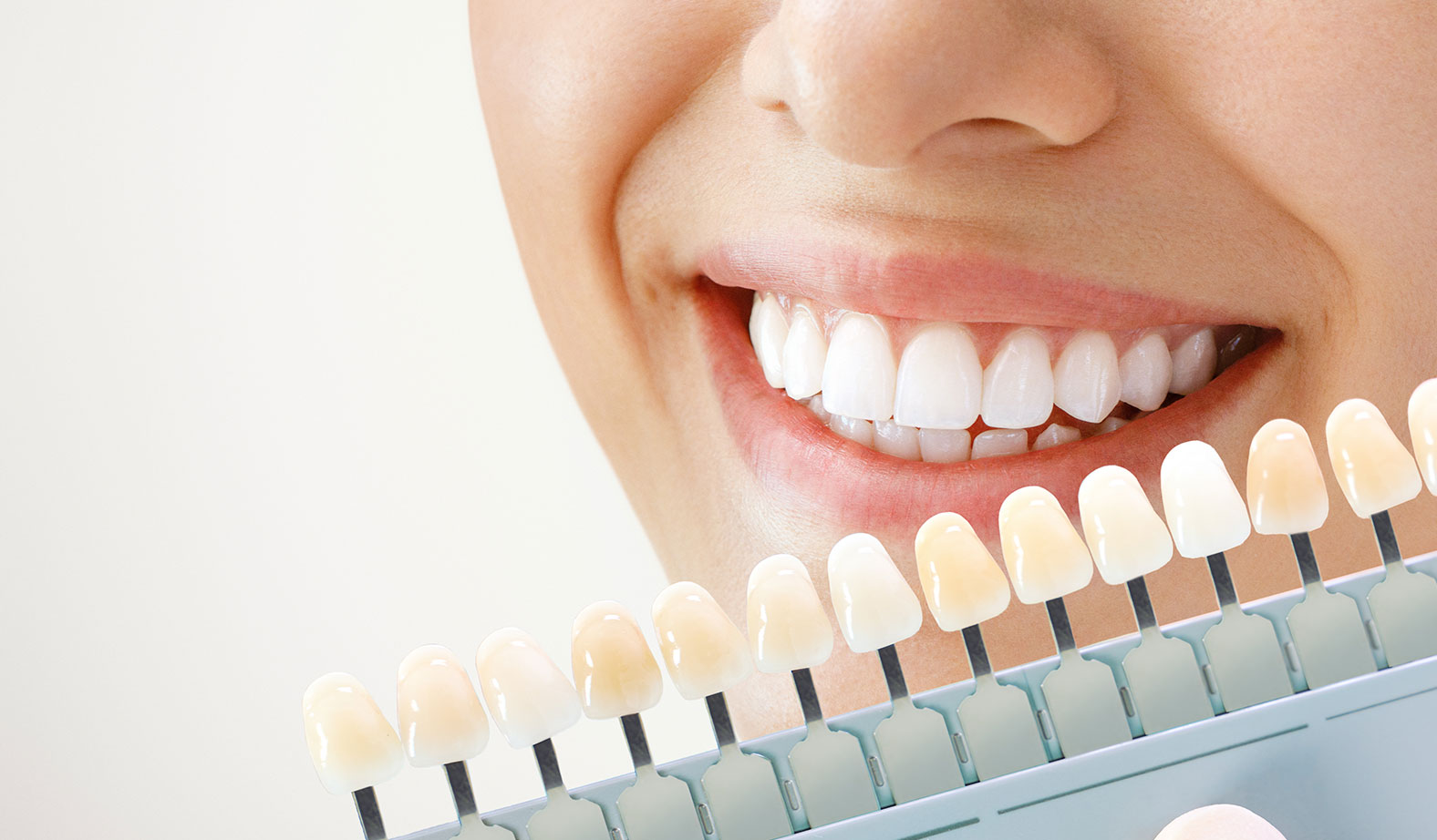 Patient that got teeth whitening