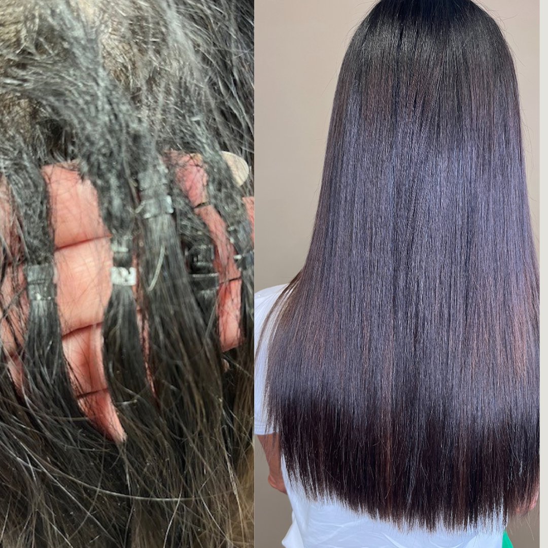 Da micro ring a nano ring Kherapy prima e dopo micro-anelli invisibili