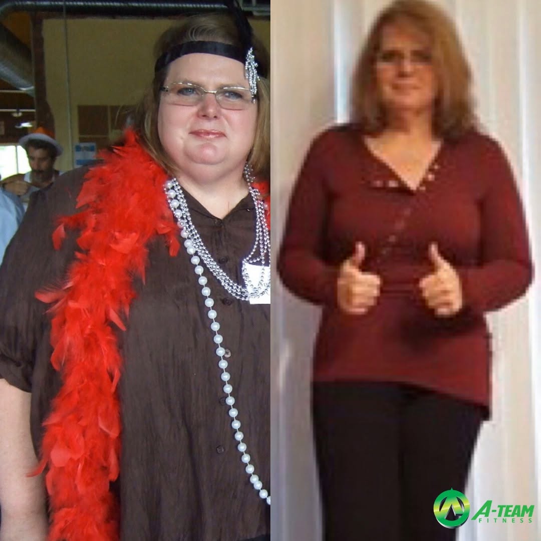 Sandy before and after losing 125 pounds