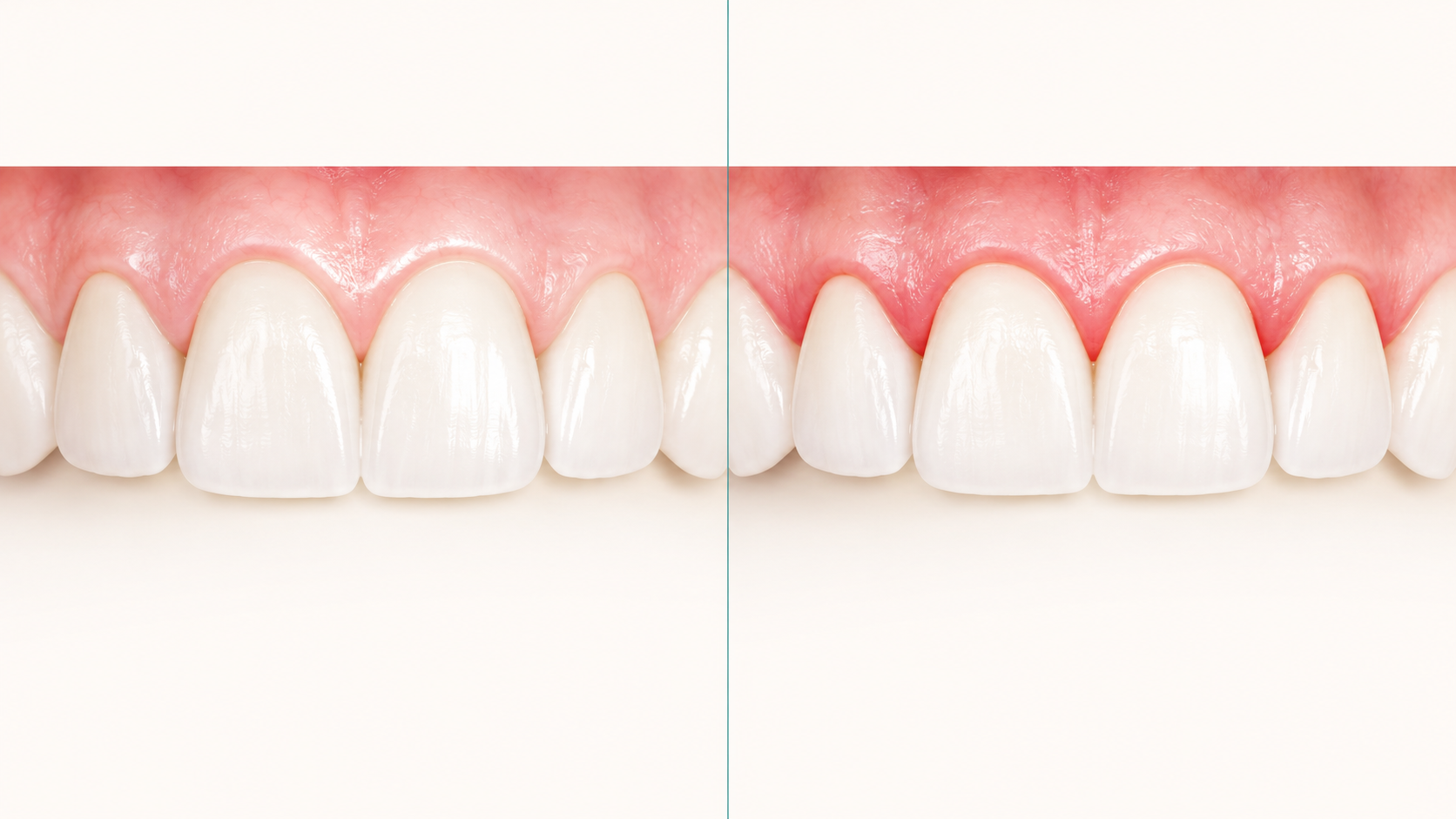 Gum disease or gum infection