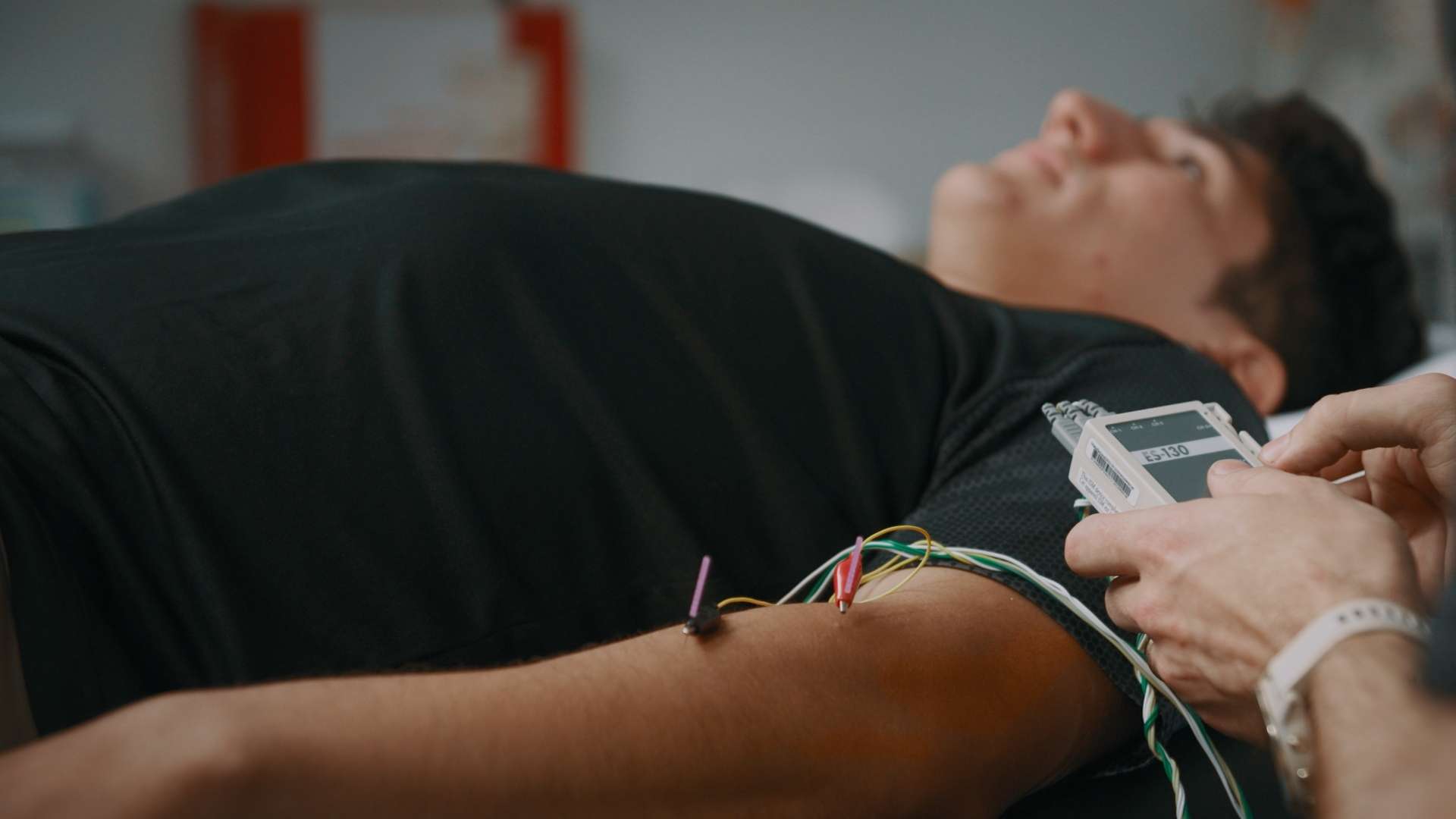 Dry needling Dry needling