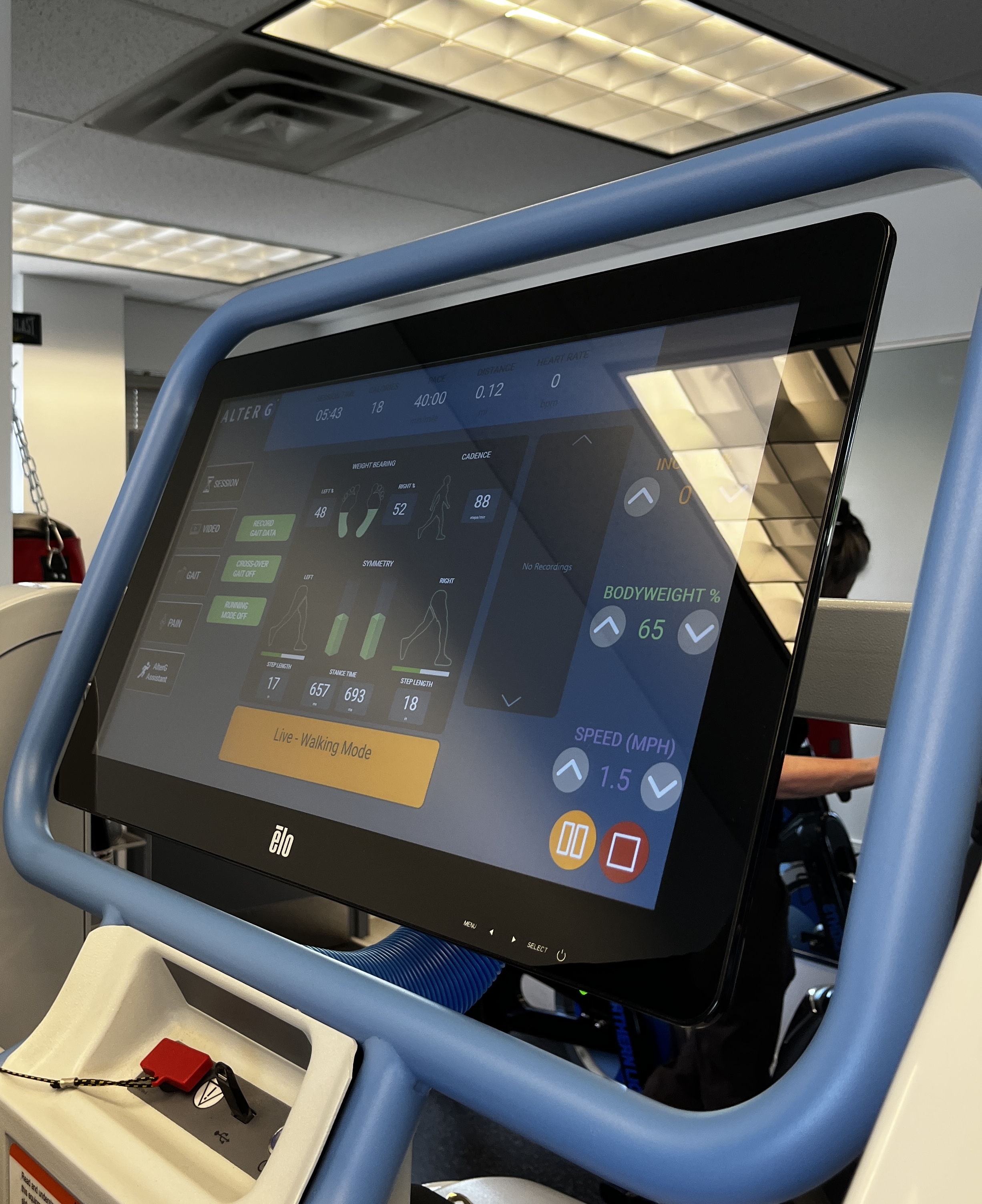 AlterG real-time gait analysis screen at MyoHealth