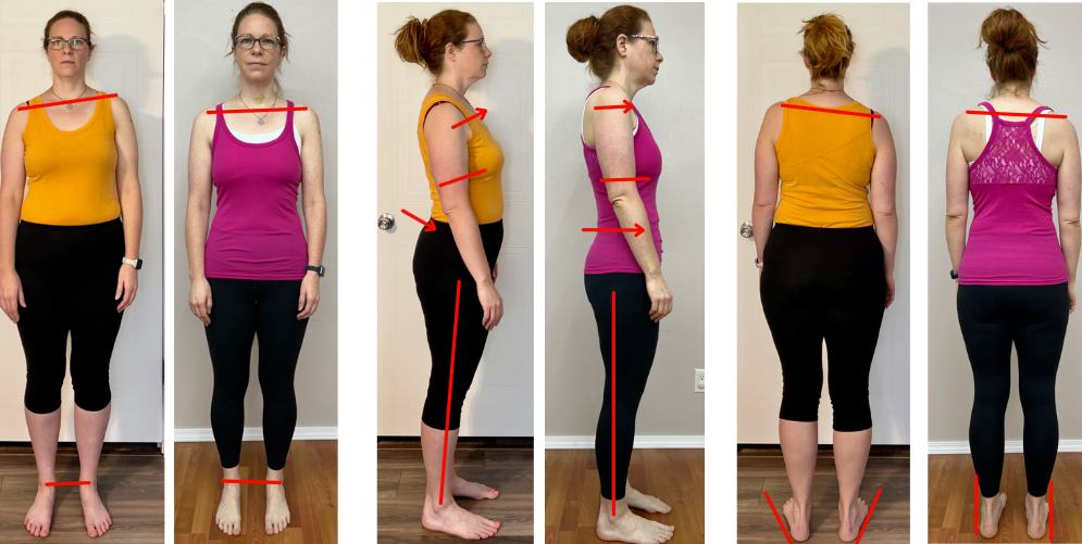 Carrie: From Chronic Back Pain to Hiking Pain-Free Carrie: From Chronic Back Pain to Hiking Pain-Free