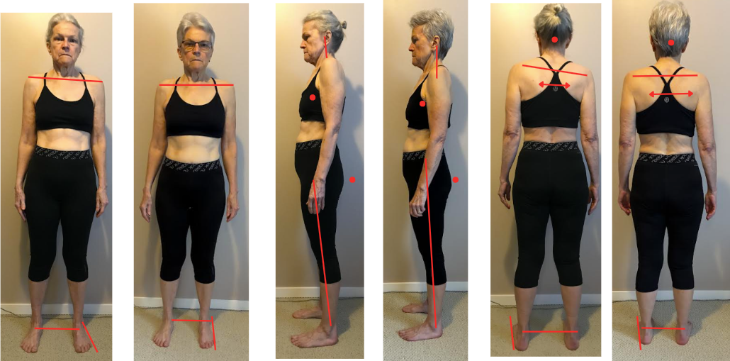 Robyn improved her hip, knee, and shoulder pain at 68