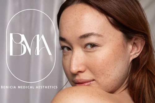 The treatment space at Benicia Medical Aesthetics