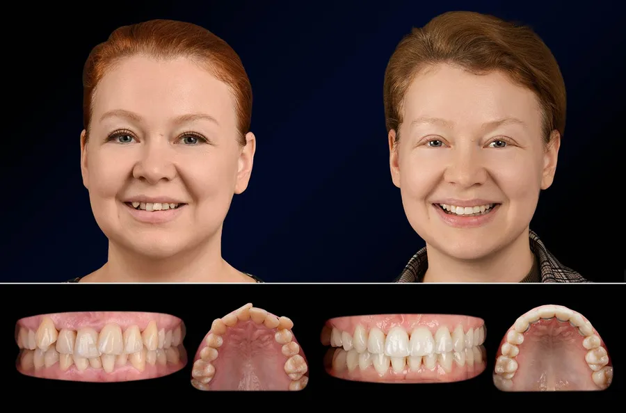 Pacient Dentus Dentino: portret și dinți înainte și după