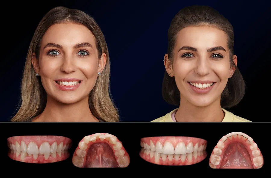 Pacient Dentus Dentino: portret și dinți înainte și după