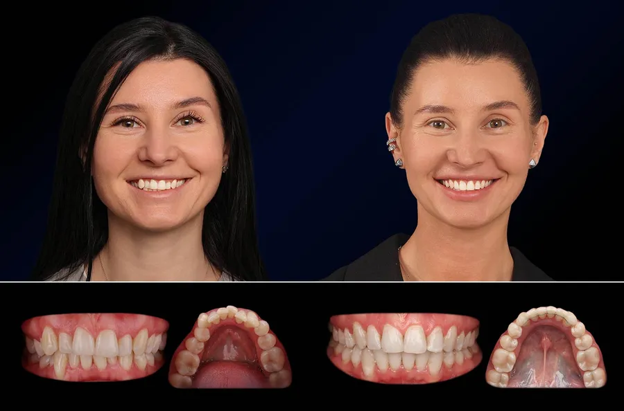 Pacient Dentus Dentino: portret și dinți înainte și după