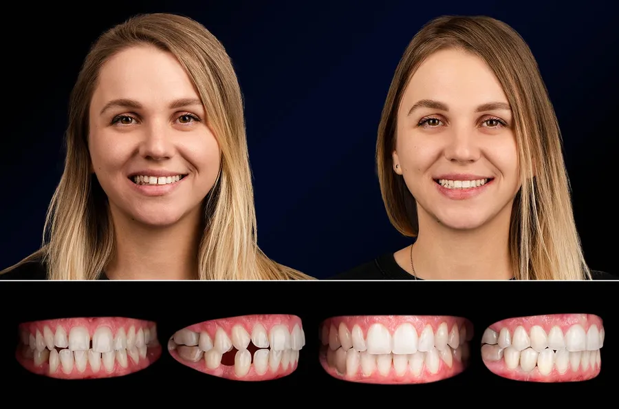 Pacient Dentus Dentino: portret și dinți înainte și după