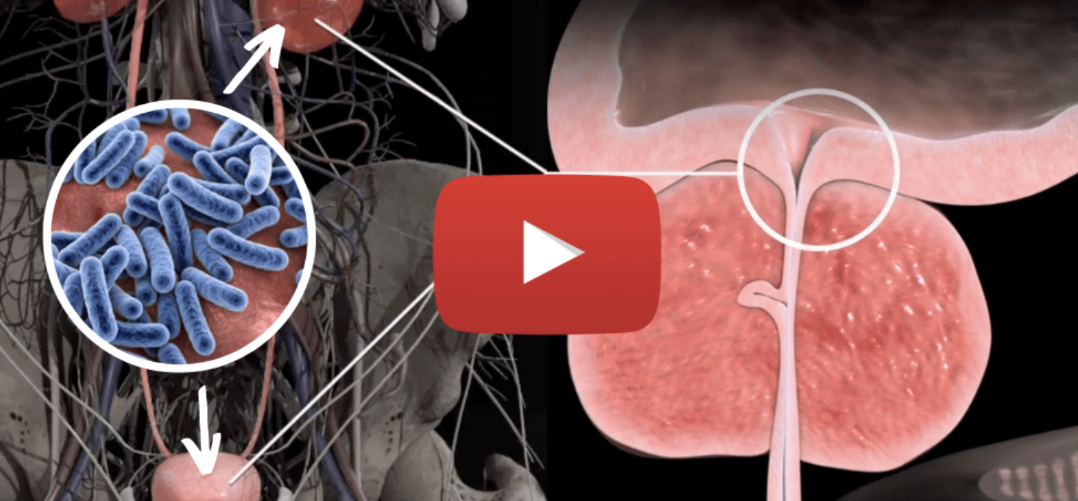 Prostate supplement