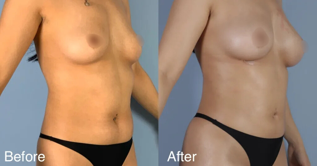  Aesthetic Nurse Practitioner Emily West oversees all Collagen Super Boost procedures at CREO Clinic.