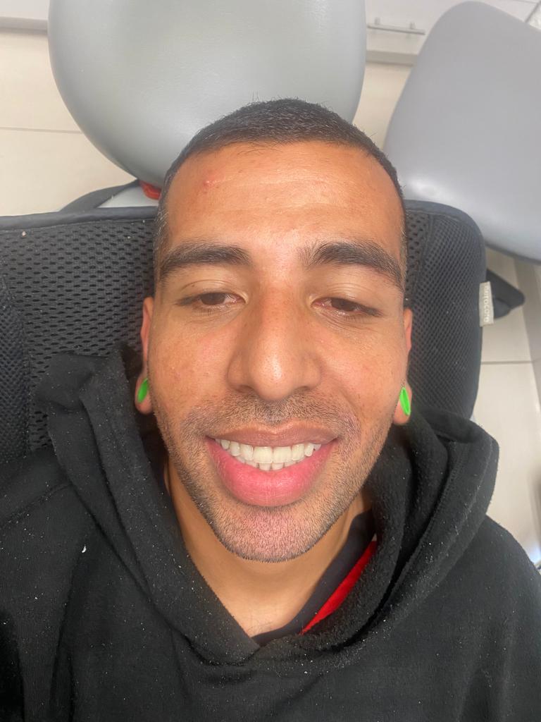 Después: el mismo paciente sonriendo con sus dientes nuevos en el consultorio