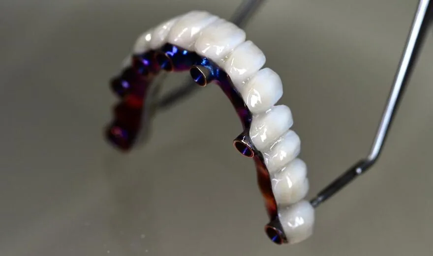 Arcada de zirconia mostrando los canales de siete implantes