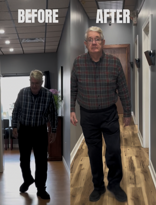 Hip Pain After Hip Replacement: Why It Happens and What Treatment Options May Help