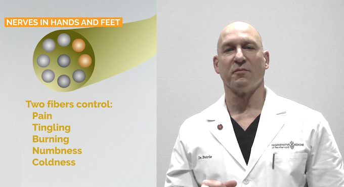Diagram of small and large nerve fibers in the hands and feet associated with neuropathy symptoms like burning, tingling, and numbness