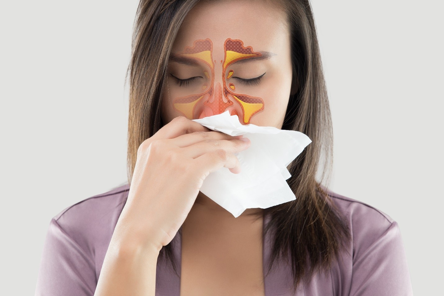 Chronic sinus congestion and restricted nasal breathing affecting sleep and daily function Chronic sinus congestion and restricted nasal breathing affecting sleep and daily function