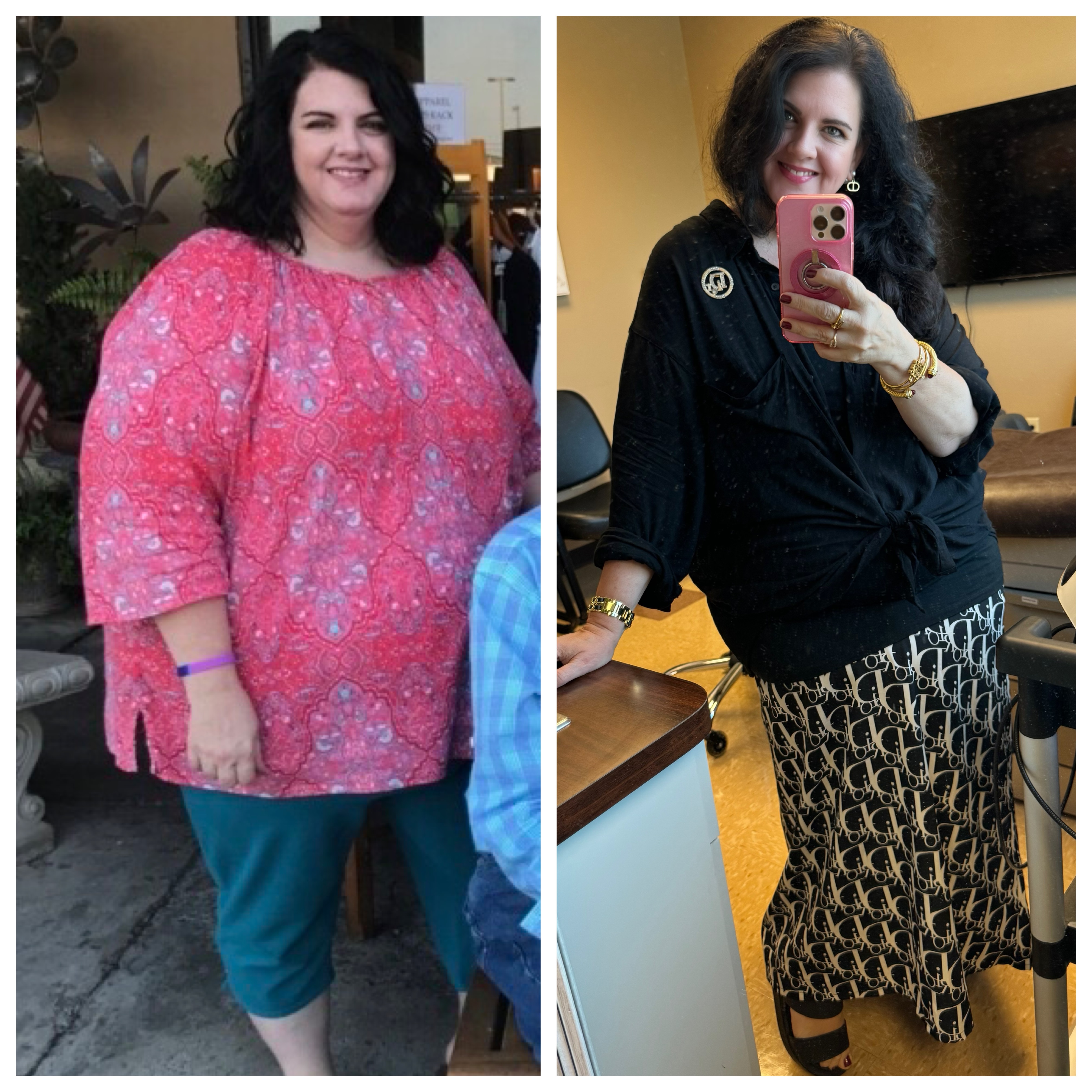 Transformation — Anne-Marie (My Wife)