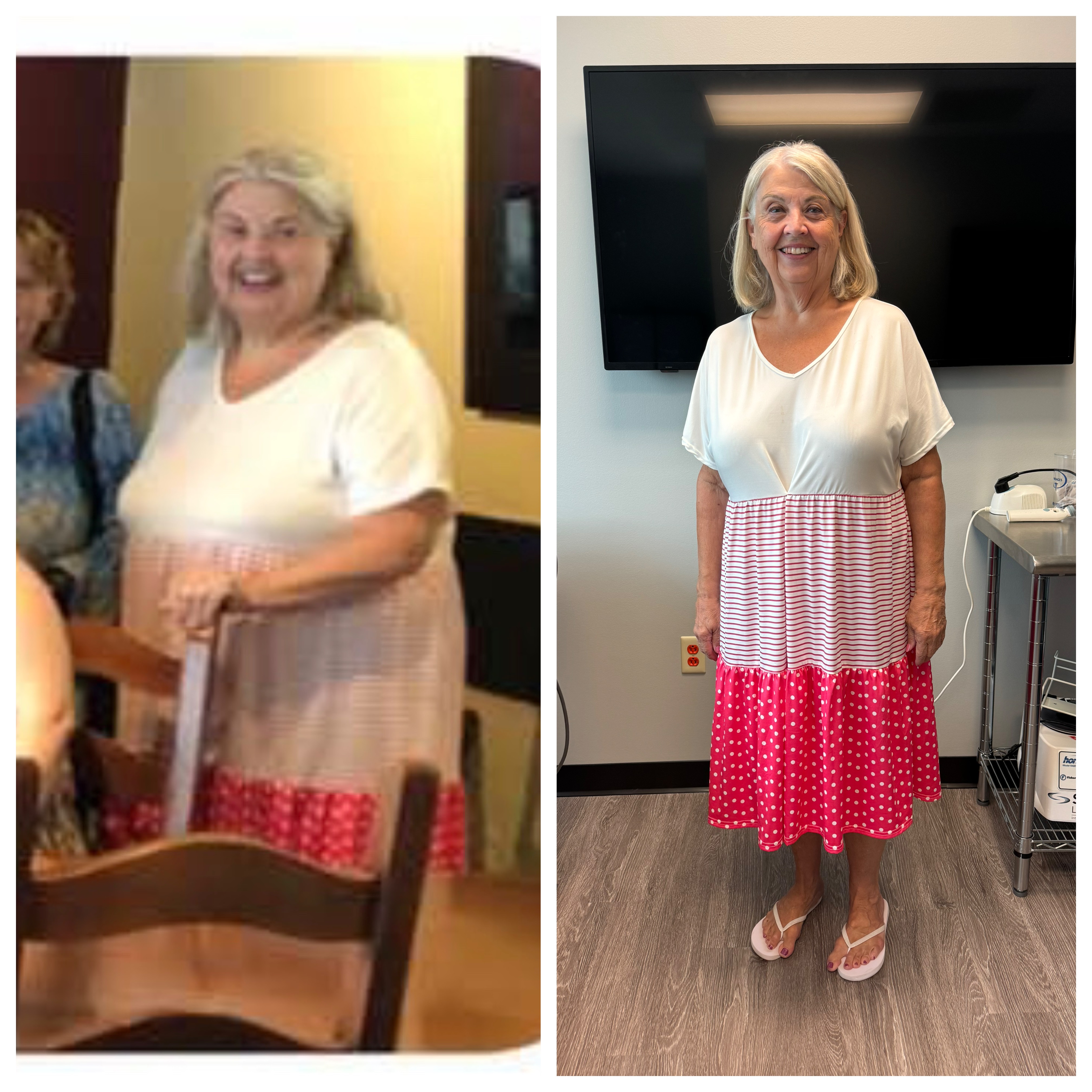 Transformation — Wife’s first grade teacher