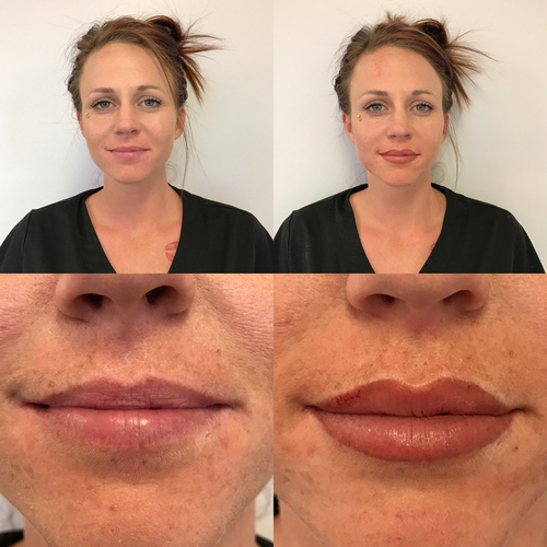 Ombré lip blush permanent lip color result in Chandler AZ by Tracey Collett