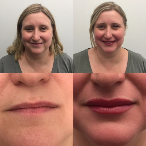 Lip blush dark lip color restoration result near Gilbert AZ