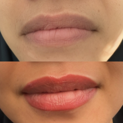 Lip blush cosmetic tattoo result in Mesa AZ by Fine Arts Permanent Cosmetics