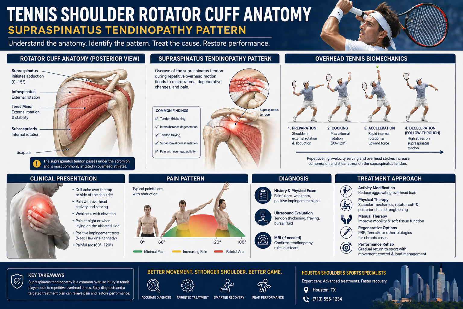 Tennis shoulder rotator cuff anatomy — supraspinatus tendinopathy pattern Tennis shoulder rotator cuff anatomy — supraspinatus tendinopathy pattern