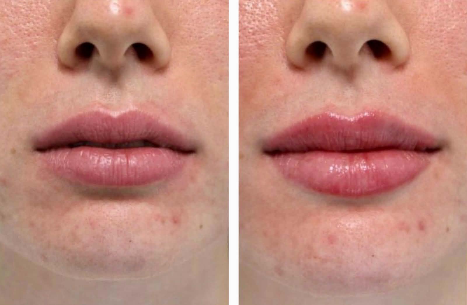 Client result 3