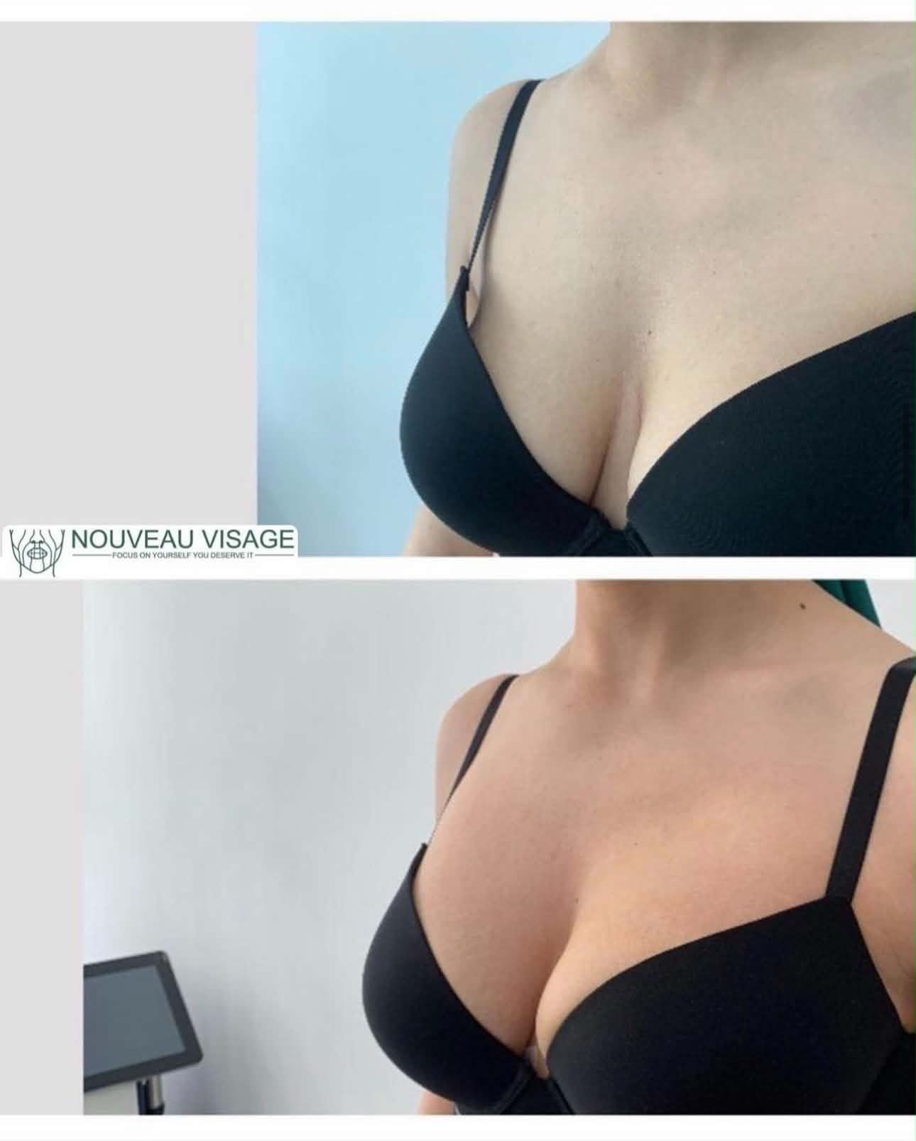 Client result 2