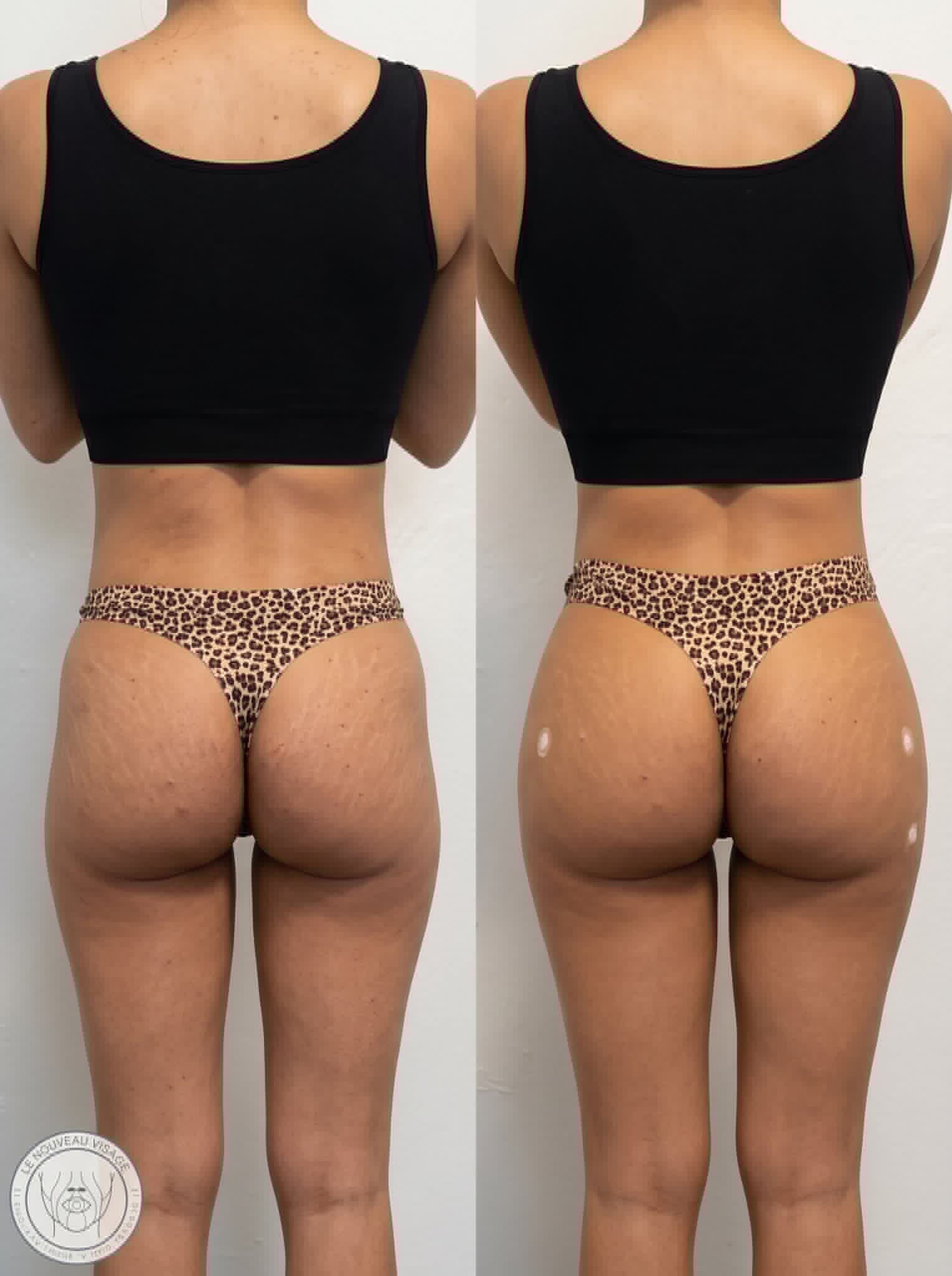 Client result 1