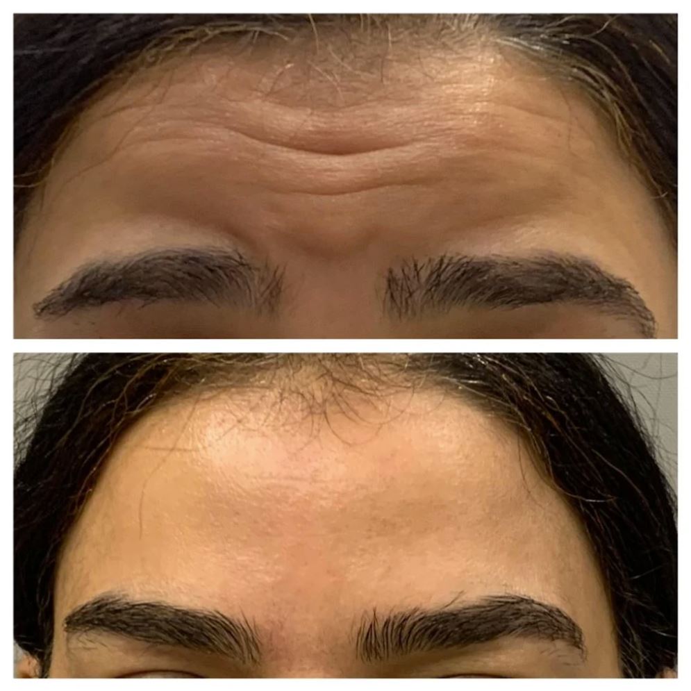 Client result 5