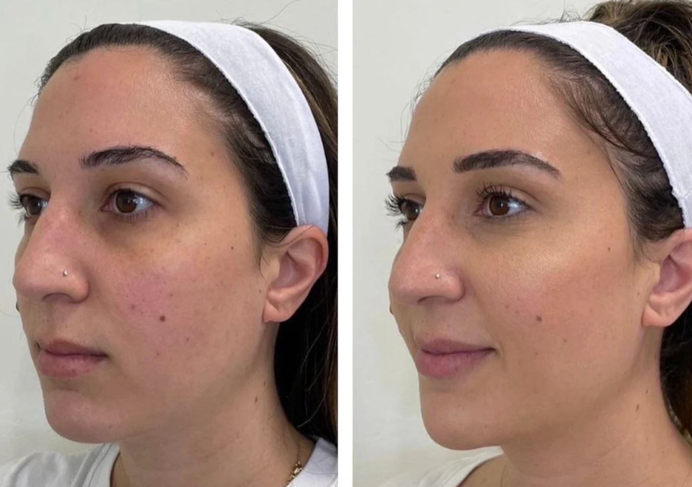 Client result 4