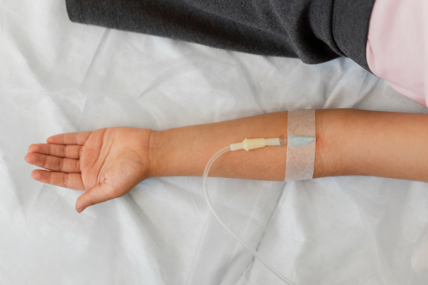 A person's arm with an IV drip