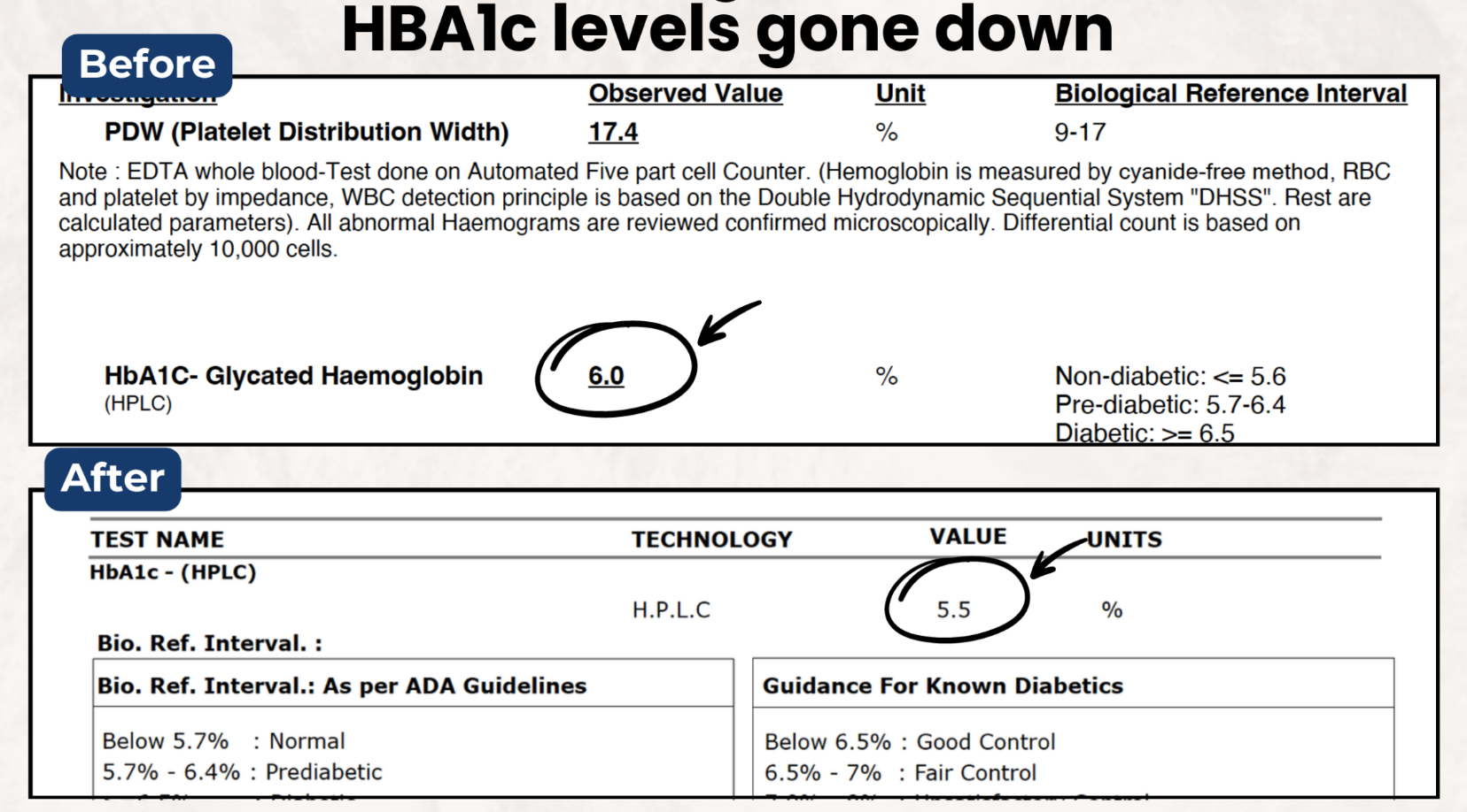 Anupama - Normalized her lipid profile