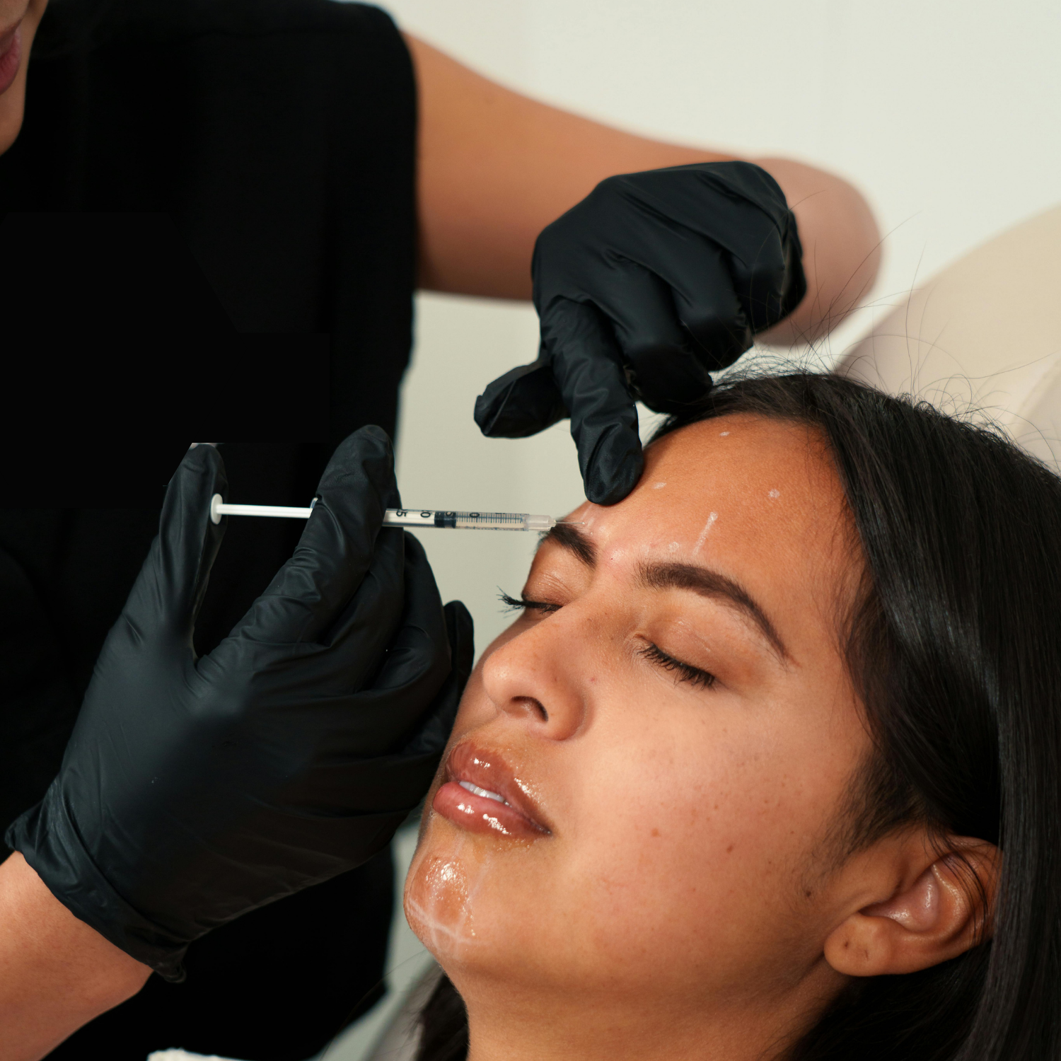 Precision neurotoxin treatment at Aesthetics by the Institute