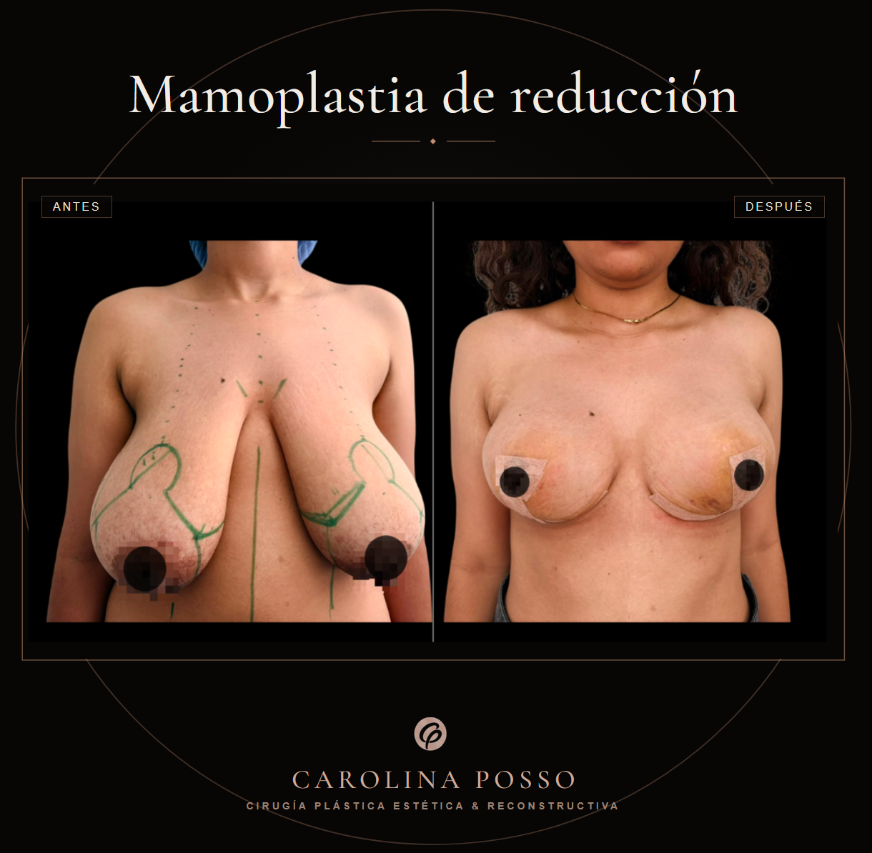 Antes y después 2