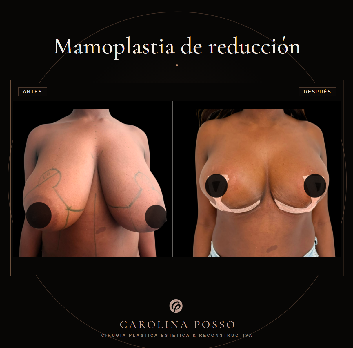 Antes y después 11