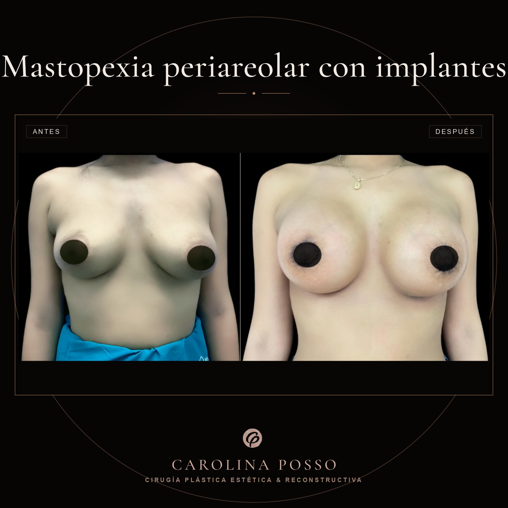 Antes y después 8