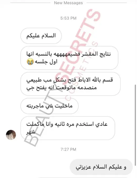 رأي عميلة