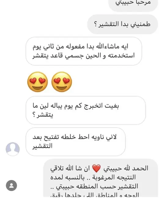 رأي عميلة
