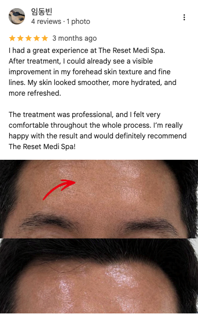 Google review 5 for The Reset Medi Spa