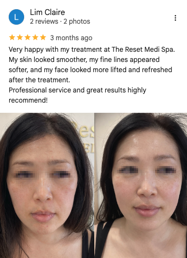 Google review 7 for The Reset Medi Spa