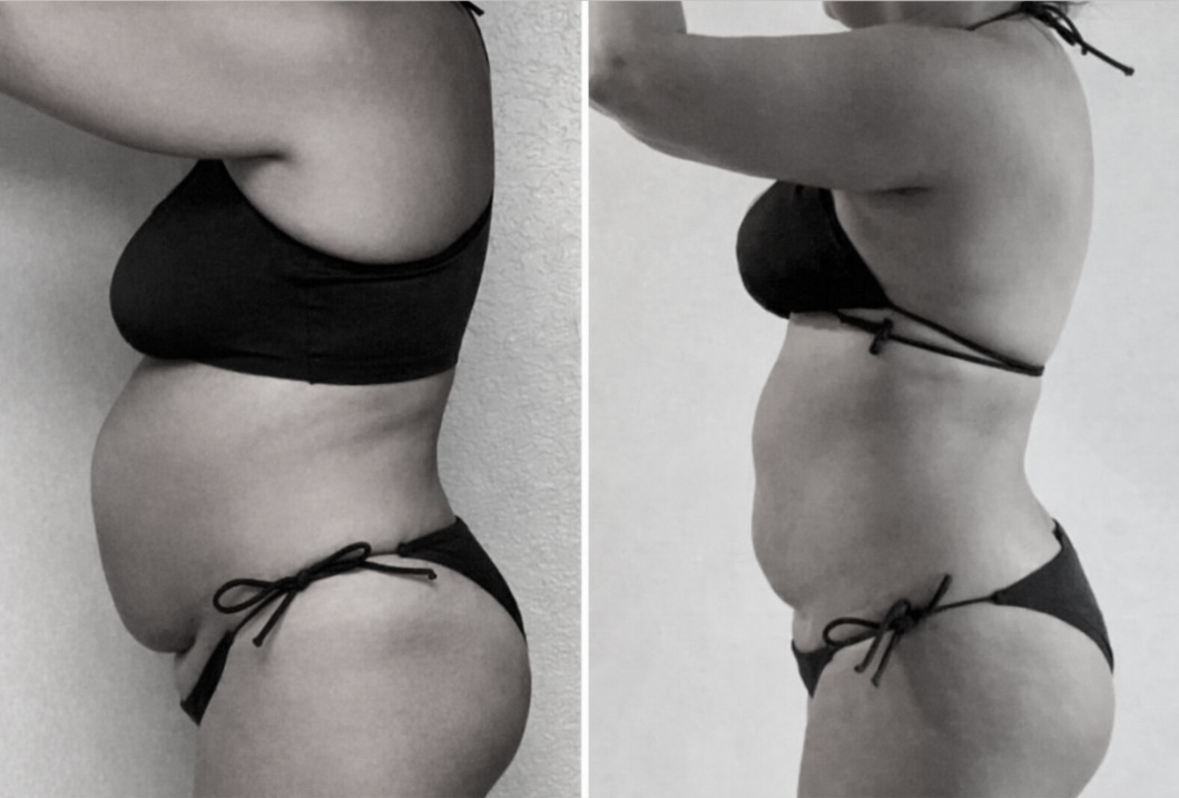 Transformación real